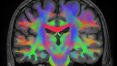 Фундаментальная медицина - 2025/2026